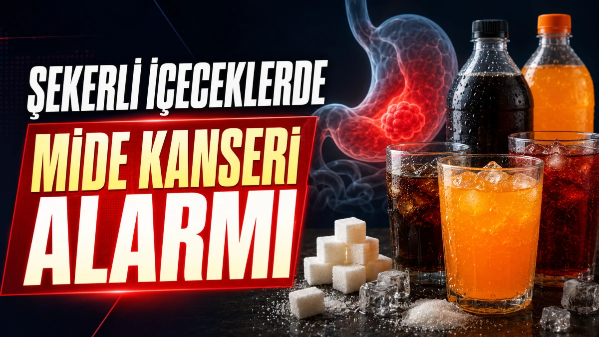 Şekerli i&ccedil;eceklerde mide kanseri alarmı: Risk 2,45 kat y&uuml;ksek &ccedil;ıktı